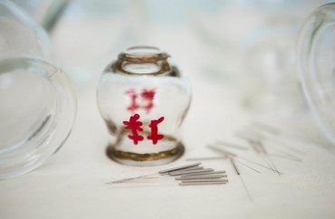 כוסות רוח ומחטי דיקור שמשמשים לטיפול של כאב גב חזק